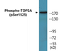 Western blot analysis of extracts from RAW264.7 cells treated with TNF 20ng/ml 5', using TOP2A (Phospho-Ser1525) Antibody.