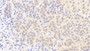 DAB staining on IHC-P; Samples: Human Adrenal gland Tissue; Primary Ab: 5μg/ml Rabbit Anti-Human OCEL1 Antibody Second Ab: 2µg/mL HRP-Linked Caprine Anti-Rabbit IgG Polyclonal Antibody