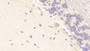 DABstainingonIHC-P.Samples:HumanTissue)