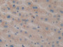 DAB staining on IHC-P; Samples: Human Liver Tissue; Primary Ab: 10µg/ml Rabbit Anti-Human CIDEC Antibody Second Ab: 2µg/mL HRP-Linked Caprine Anti-Rabbit IgG Polyclonal Antibody