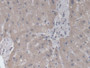 DAB staining on IHC-P; Samples: Human Liver Tissue;  Primary Ab: 20µg/ml Rabbit Anti-Human RAB37 Ant