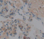 V-Ral Simian Leukemia Viral Oncogene Homolog A (RALA) Polyclonal Antibody, Cat#CAU21346