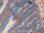 DAB staining on IHC-P; Samples: Rat Intestine Tissue; Primary Ab: 20µg/ml Rabbit Anti-Rat SEMA3A Antibody Second Ab: 2µg/mL HRP-Linked Caprine Anti-Rabbit IgG Polyclonal Antibody
