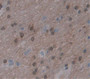 Used in DAB staining on fromalin fixed paraffin- embedded Kidney tissue