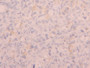 DAB staining on IHC-P; Samples: Human Ovary Tissue DAB staining on IHC-P; Samples: Human Ovary Tissue