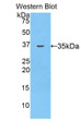 Western Blot; Sample: Recombinant protein.