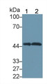 Western Blot; Sample: Lane1: Mouse Brain lysate; Lane2: Rat Brain lysate; Primary Ab: 1µg/mL Rabbit Anti-Human SPRED2 Antibody; Second Ab: 0.2µg/mL HRP-Linked Caprine Anti-Rabbit IgG Polyclonal Antibody; Western Blot; Sample: Lane1: Mouse Brain lysate; Lane2: Rat Brain lysate; Primary Ab: 1µg/mL Rabbit Anti-Human SPRED2 Antibody; Second Ab: 0.2µg/mL HRP-Linked Caprine Anti-Rabbit IgG Polyclonal Antibody;