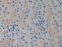 DAB staining on IHC-P; Samples: Rat Kidney Tissue; Primary Ab: 10µg/ml Rabbit Anti-Rat SPRY2 Antibody Second Ab: 2µg/mL HRP-Linked Caprine Anti-Rabbit IgG Polyclonal Antibody DAB staining on IHC-P; Samples: Rat Kidney Tissue; Primary Ab: 10µg/ml Rabbit Anti-Rat SPRY2 Antibody Second Ab: 2µg/mL HRP-Linked Caprine Anti-Rabbit IgG Polyclonal Antibody