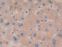 DAB staining on IHC-P; Samples: Human Liver Tissue; Primary Ab: 10µg/ml Rabbit Anti-Human NOD1 Antibody Second Ab: 2µg/mL HRP-Linked Caprine Anti-Rabbit IgG Polyclonal Antibody DAB staining on IHC-P; Samples: Human Liver Tissue; Primary Ab: 10µg/ml Rabbit Anti-Human NOD1 Antibody Second Ab: 2µg/mL HRP-Linked Caprine Anti-Rabbit IgG Polyclonal Antibody
