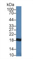 Western Blot; Sample: Porcine Cerebrum lysate; Primary Ab: 1µg/ml Rabbit Anti-Human NME3 Antibody Second Ab: 0.2µg/mL HRP-Linked Caprine Anti-Rabbit IgG Polyclonal Antibody Western Blot; Sample: Porcine Cerebrum lysate; Primary Ab: 1µg/ml Rabbit Anti-Human NME3 Antibody Second Ab: 0.2µg/mL HRP-Linked Caprine Anti-Rabbit IgG Polyclonal Antibody