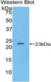 Western Blot; Sample: Recombinant protein. Western Blot; Sample: Recombinant protein.
