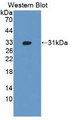 Western Blot; Sample: Recombinant protein. Western Blot; Sample: Recombinant protein.