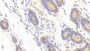 DABstainingonIHC-P.Samples:HumanTissue) DABstainingonIHC-P.Samples:HumanTissue)