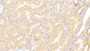 DAB staining on IHC-P; Samples: Human Kidney Tissue; Primary Ab: 20μg/ml Rabbit Anti-Human ADAMTS9 Antibody Second Ab: 2µg/mL HRP-Linked Caprine Anti-Rabbit IgG Polyclonal Antibody DAB staining on IHC-P; Samples: Human Kidney Tissue; Primary Ab: 20μg/ml Rabbit Anti-Human ADAMTS9 Antibody Second Ab: 2µg/mL HRP-Linked Caprine Anti-Rabbit IgG Polyclonal Antibody