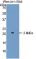 Western Blot; Sample: Recombinant ADAMTS2, Mouse.