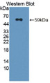 Western Blot; Sample: Recombinant protein. Western Blot; Sample: Recombinant protein.