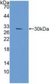 Western Blot; Sample: Recombinant RAD50, Mouse. Western Blot; Sample: Recombinant RAD50, Mouse.