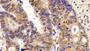 DABstainingonIHC-P.Samples:HumanTissue) DABstainingonIHC-P.Samples:HumanTissue)
