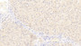 DAB staining on IHC-P; Samples: Human Liver Tissue; Primary Ab: 20μg/ml Rabbit Anti-Human NUMB Antibody Second Ab: 2µg/mL HRP-Linked Caprine Anti-Rabbit IgG Polyclonal Antibody DAB staining on IHC-P; Samples: Human Liver Tissue; Primary Ab: 20μg/ml Rabbit Anti-Human NUMB Antibody Second Ab: 2µg/mL HRP-Linked Caprine Anti-Rabbit IgG Polyclonal Antibody