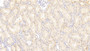 DAB staining on IHC-P. Samples: Human Tissue) DAB staining on IHC-P. Samples: Human Tissue)