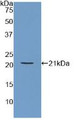 Western Blot; Sample: Recombinant ARPC4, Human. Western Blot; Sample: Recombinant ARPC4, Human.