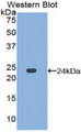 Western Blot; Sample: Recombinant protein. Western Blot; Sample: Recombinant protein.