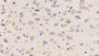 DAB staining on IHC-P; Samples: Mouse Cerebrum Tissue; Primary Ab: 20µg/ml Rabbit Anti-Mouse LCAT Antibody Second Ab: 2µg/mL HRP-Linked Caprine Anti-Rabbit IgG Polyclonal Antibody DAB staining on IHC-P; Samples: Mouse Cerebrum Tissue; Primary Ab: 20µg/ml Rabbit Anti-Mouse LCAT Antibody Second Ab: 2µg/mL HRP-Linked Caprine Anti-Rabbit IgG Polyclonal Antibody