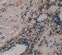 Diaphanous Homolog 1 (DIAPH1) Polyclonal Antibody, Cat#CAU21768 Diaphanous Homolog 1 (DIAPH1) Polyclonal Antibody, Cat#CAU21768