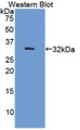 Western Blot; Sample: Recombinant protein. Western Blot; Sample: Recombinant protein.