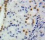 Used in DAB staining on fromalin fixed paraffin-embedded Kidney tissue Used in DAB staining on fromalin fixed paraffin-embedded Kidney tissue