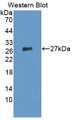 Western Blot; Sample: Recombinant protein. Western Blot; Sample: Recombinant protein.