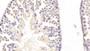 DAB staining on IHC-P; Samples: Mouse Testis Tissue;  Primary Ab: 10μg/ml Rabbit Anti-Mouse EPYC Antibody Second Ab: 2µg/mL HRP-Linked Caprine Anti-Rabbit IgG Polyclonal Antibody  DAB staining on IHC-P; Samples: Mouse Testis Tissue;  Primary Ab: 10μg/ml Rabbit Anti-Mouse EPYC Antibody Second Ab: 2µg/mL HRP-Linked Caprine Anti-Rabbit IgG Polyclonal Antibody