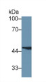 Western Blot; Sample: Human Liver lysate; Primary Ab: 1µg/ml Rabbit Anti-Human FAH Antibody Second Ab: 0.2µg/mL HRP-Linked Caprine Anti-Rabbit IgG Polyclonal Antibody Western Blot; Sample: Human Liver lysate; Primary Ab: 1µg/ml Rabbit Anti-Human FAH Antibody Second Ab: 0.2µg/mL HRP-Linked Caprine Anti-Rabbit IgG Polyclonal Antibody