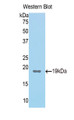 Western Blot; Sample: Recombinant protein. Western Blot; Sample: Recombinant protein.