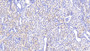 DAB staining on IHC-P; Samples: Human Kidney Tissue;  Primary Ab: 20μg/ml Rabbit Anti-Human FAH Antibody Second Ab: 2µg/mL HRP-Linked Caprine Anti-Rabbit IgG Polyclonal Antibody  DAB staining on IHC-P; Samples: Human Kidney Tissue;  Primary Ab: 20μg/ml Rabbit Anti-Human FAH Antibody Second Ab: 2µg/mL HRP-Linked Caprine Anti-Rabbit IgG Polyclonal Antibody