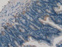 DAB staining on fromalin fixed paraffin- embedded intestine tissue) DAB staining on fromalin fixed paraffin- embedded intestine tissue)