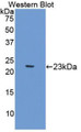 Western Blot; Sample: Recombinant protein. Western Blot; Sample: Recombinant protein.