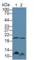 Western Blot; Sample: Lane1: Rat Stomach lysate; Lane2: Mouse Stomach lysate; Primary Ab: 2µg/mL Rabbit Anti-Human GKN2 Antibody; Second Ab: 0.2µg/mL HRP-Linked Caprine Anti-Rabbit IgG Polyclonal Antibody; Western Blot; Sample: Lane1: Rat Stomach lysate; Lane2: Mouse Stomach lysate; Primary Ab: 2µg/mL Rabbit Anti-Human GKN2 Antibody; Second Ab: 0.2µg/mL HRP-Linked Caprine Anti-Rabbit IgG Polyclonal Antibody;