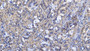 DAB staining on IHC-P; Samples: Human Stomach Tissue; Primary Ab: 20µg/ml Rabbit Anti-Human GKN2 Antibody Second Ab: 2µg/mL HRP-Linked Caprine Anti-Rabbit IgG Polyclonal Antibody DAB staining on IHC-P; Samples: Human Stomach Tissue; Primary Ab: 20µg/ml Rabbit Anti-Human GKN2 Antibody Second Ab: 2µg/mL HRP-Linked Caprine Anti-Rabbit IgG Polyclonal Antibody