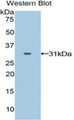 Western Blot; Sample: Recombinant protein. Western Blot; Sample: Recombinant protein.