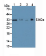 Western Blot; Sample: Lane1: Human Lung Tissue; Lane2: Human Hepg2 Cells; Lane3: Human 293T Cells; Lane4: Porcine Lymph Node Tissue. Western Blot; Sample: Lane1: Human Lung Tissue; Lane2: Human Hepg2 Cells; Lane3: Human 293T Cells; Lane4: Porcine Lymph Node Tissue.