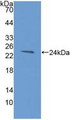 Western Blot; Sample: Recombinant HAVCR2, Human. Western Blot; Sample: Recombinant HAVCR2, Human.