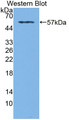 Western Blot; Sample: Recombinant protein. Western Blot; Sample: Recombinant protein.