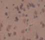 Used in DAB staining on fromalin fixed paraffin- embedded Kidney tissue Used in DAB staining on fromalin fixed paraffin- embedded Kidney tissue