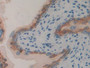DAB staining on fromalin fixed paraffin- embedded Kidney tissue) DAB staining on fromalin fixed paraffin- embedded Kidney tissue)