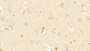 DAB staining on IHC-P; Samples: Human Cerebrum Tissue; Primary Ab: 20μg/ml Rabbit Anti-Human HAP1 Antibody Second Ab: 2µg/mL HRP-Linked Caprine Anti-Rabbit IgG Polyclonal Antibody DAB staining on IHC-P; Samples: Human Cerebrum Tissue; Primary Ab: 20μg/ml Rabbit Anti-Human HAP1 Antibody Second Ab: 2µg/mL HRP-Linked Caprine Anti-Rabbit IgG Polyclonal Antibody
