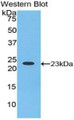 Western Blot; Sample: Recombinant protein. Western Blot; Sample: Recombinant protein.