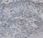 Hornerin (HRNR) Polyclonal Antibody, Cat#CAU21840 Hornerin (HRNR) Polyclonal Antibody, Cat#CAU21840