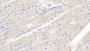 DABstainingonIHC-P.Samples:HumanTissue)