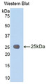 Western Blot; Sample: Recombinant protein. Western Blot; Sample: Recombinant protein.